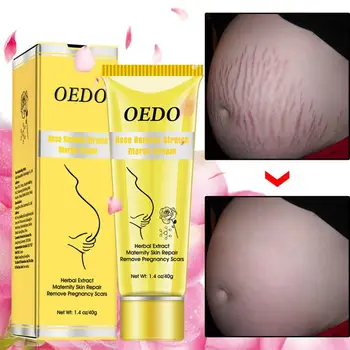 

Rose Remove Stretch Marks Cream Anti Wrinkle Anti Aging Maternity Skin Repair Remove Pregnancy Scars Body Skin Care TSLM1