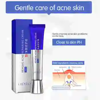 

Acne Treatment Cream With Extract Of Gentian Root Formula Convergence Pores Mildly Relieve Acne Cream