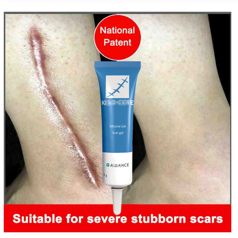 ointment for face scars