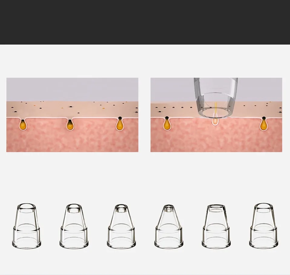 Дарсонваль для удаления угрей устройство для удаления прыщей инструмент акне инструменты поры вакуумный аппарат для очистки пор, в черный горошек для маленьких девочек вакуумный средства для ухода за кожей