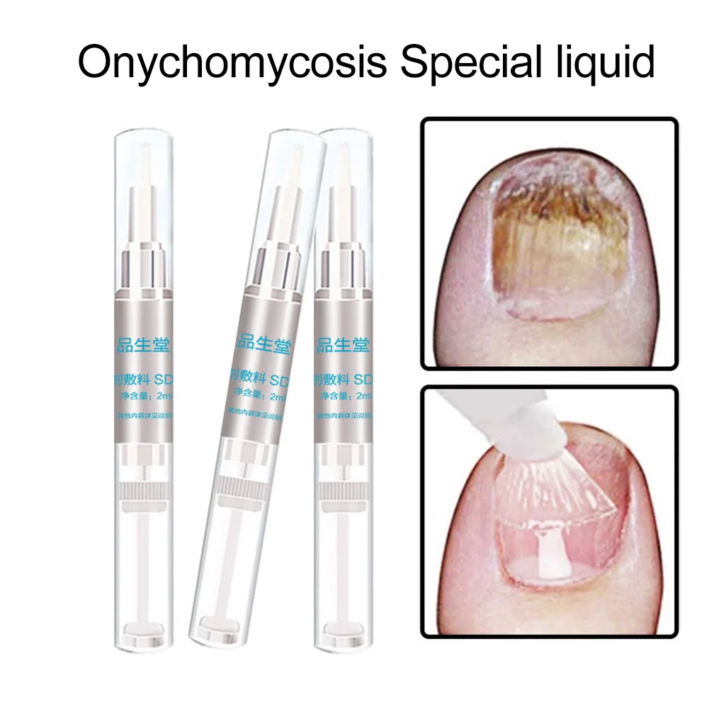 Onychomycosis Paronychia Лечение ногтей Уход за пальцами травяная анти грибок жидкая ручка дизайн ногтей и инструменты маленькая бутылка, дизайн кисти, легко