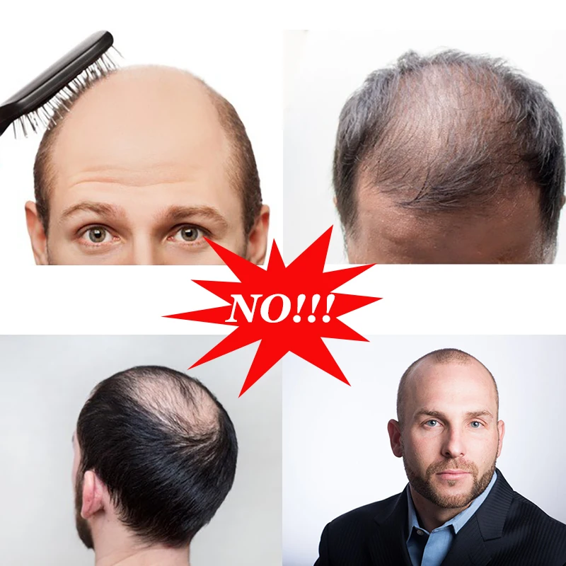 Человеческие волосы remy, парик для мужчин, моно кружево и NPU, шиньон, натуральный вид, волосы remy для мужчин, парик для мужчин