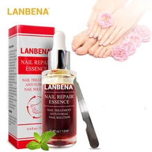 Грибка ногтей восстанавливающая эссенция, грибковые заболевания, ногти для ног "францзуский маникюр" лечение анти-Infectionl трещины для предотвращения онихомикоз паронихии инструмент для ухода за ногтями