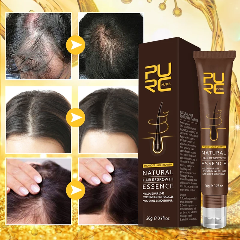 PURC Hair Growth Oil Ginger Essence Fast Growing Hair Products Scalp Treatment Care Set