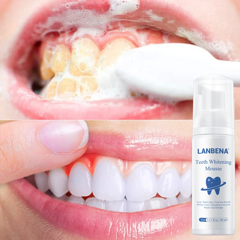 LANBENA Teeth Whitening Mousse Tooth Whitening Cleaning White Teeth Oral Hygiene Toothpaste Bleaching Remove Stains Dental Tool