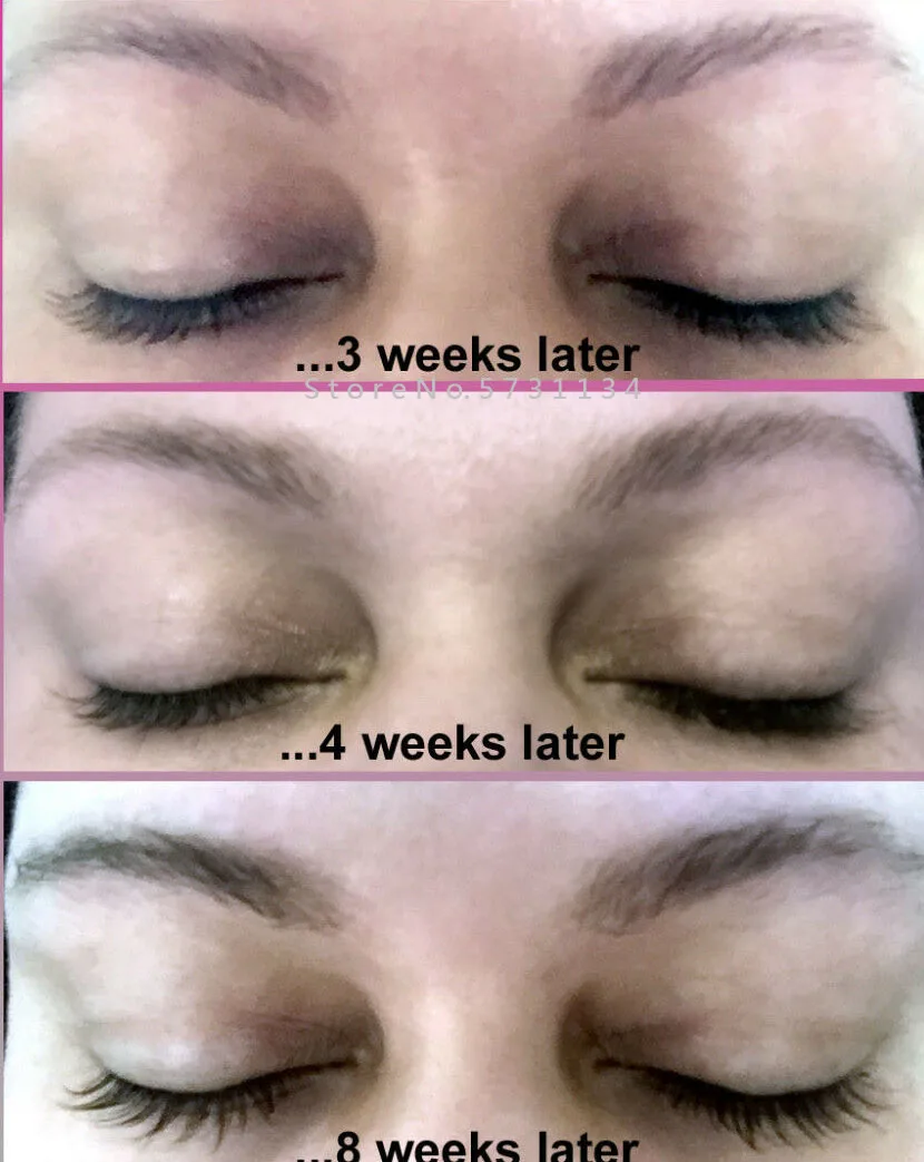 Before and After Best Organic Eyelash Growth Serum Safe for Eyebrows Fast Hair Eyelashes | Красота и здоровье