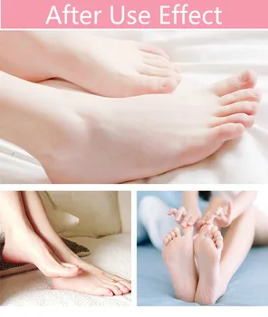 

Electric Pedicure Foot Care Tool Files Pedicure Callus Remover Rechargeable Sawing File For Feet Dead Skin Callus Peel Remover