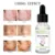 No Trace Mole Removal Cream Эфирное Масло 20 мл Органические Теги Растворы Сыворотка Skin Tag Mole Freckle Spot Fast Remover Уход За Кожей