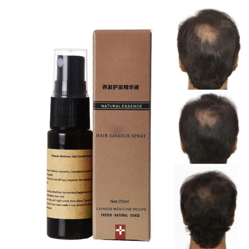 

Hot Fast Hair Growth Essence Liquid 20m Products Anti Gray Hair Spray Shampoo Serum Hair Loss Treatment Hair Care Product