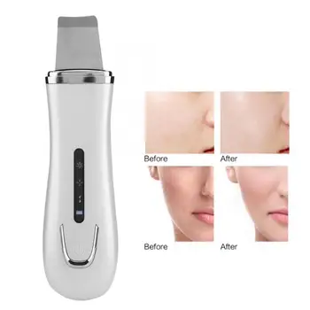

Ultrasonic Face Skin Scrubber Blackhead Removal Ion Cleaner Facial Cleanser Beauty Tool Facial Care Tool