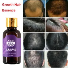 Уход за волосами, эссенция, предотвращение выпадения волос, эффективный рост, питает, контроль над маслом, рост волос, плотный, быстрый, толстый шампунь, анти