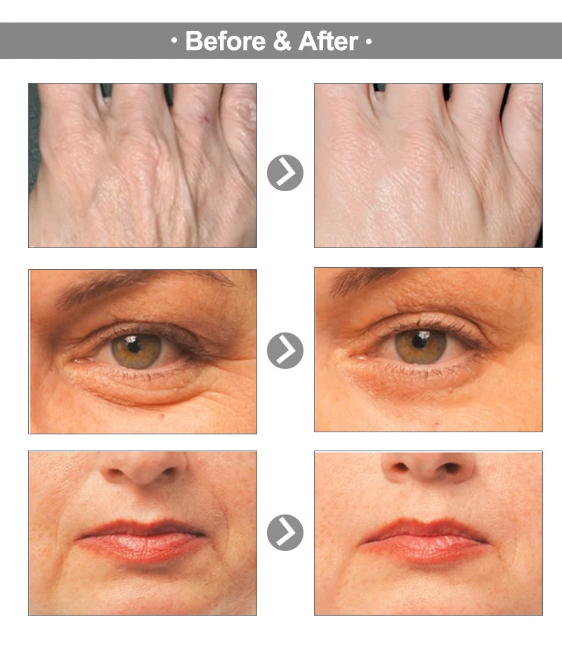 AuQuest 5 Seconds Wrinkle Remover Instant Firmly Anti Aging Moisturizing Remove Fineline Face Cream Beauty Skin Care 20G-4