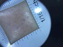 Lupa con mango de dermatoscopio 10X, visión clara suave con escala de medida, 30X, tipo B, visión más grande con luz UV