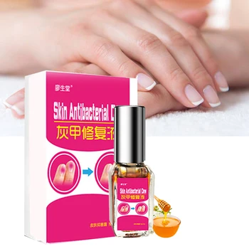 

Fungal Nail Treatment Feet Care Essence Nail Foot Whitening Toe Nail Fungus Removal Gel Anti Infection Paronychia Onychomycosis