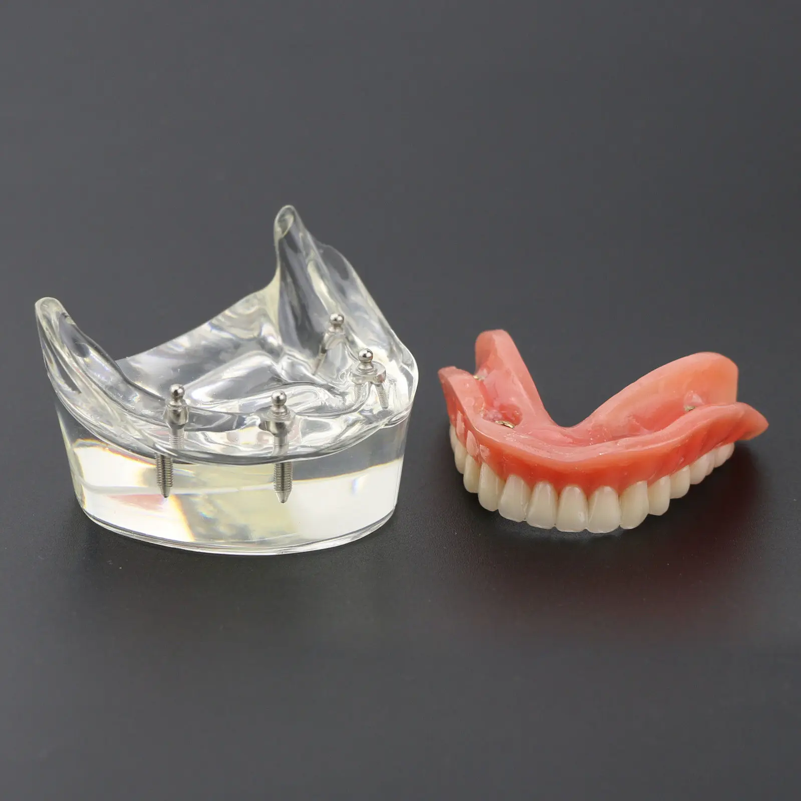 1 шт. Стоматологическая модель исследования зубов Overdenture NOR 4 имплантата Demo модель 6002 02