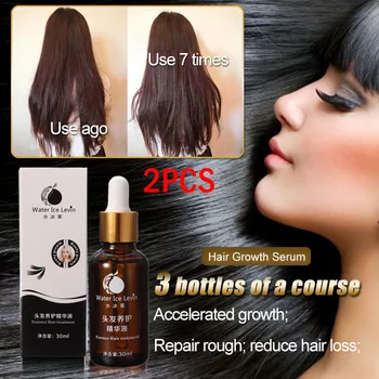 

Shampoo Fast Hair Growth Serum Hair Loss Treatment Fibers Growing-faster Anti Hair Loss Hair Growth Fluid Hair care шампунь