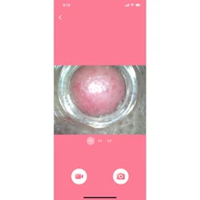 Eliminador de espinillas por calor, aspiradora de poros para nariz, cara, acné, succión, pantalla LCD recargable, herramientas de eliminación de puntos de succión