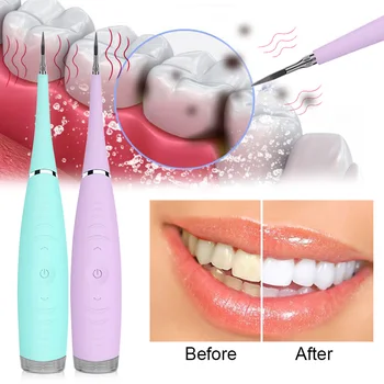 

Tooth Cleaner Electric Ultrasonic Sonic Dental Scaler Calculus Remover Whiten Stains Tartar Tool Whiten Teeth Remove