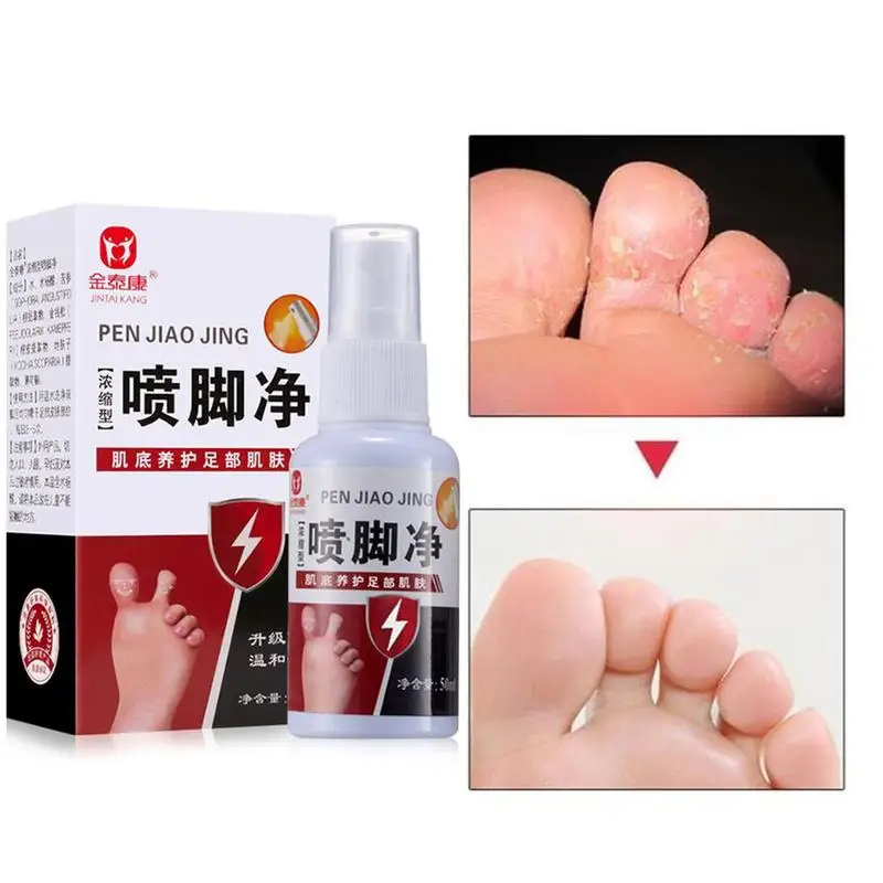 1 pcs Anti-Beriberi Spray Foot Deodorant Odor Remover Athletes Anti-fall Anti-bacteria Fungus Feet Care Supplies | Красота и здоровье