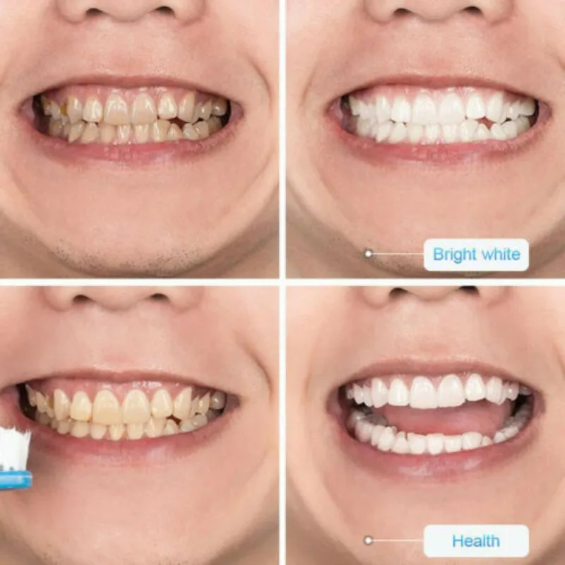 100ML Pressed Toothpaste Toothpaste Stain Removal Whitening Blueberry Toothpaste Fight Bleeding Gums Teeth Whitening Tool 100ML Pressed Toothpaste Toothpaste Stain Removal Whitening Blueberry Toothpaste Fight Bleeding Gums Teeth Whitening Tool
