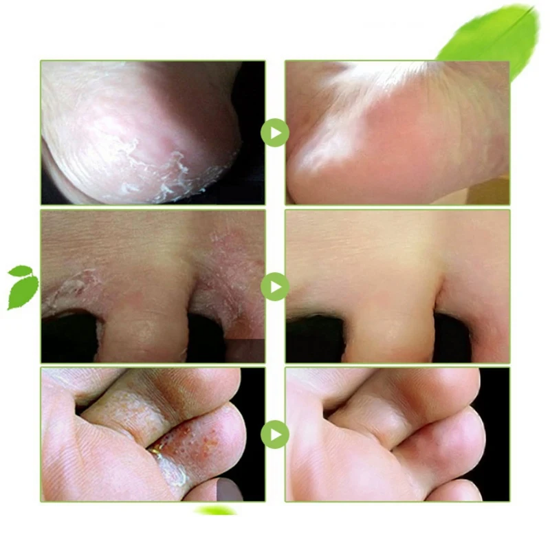 NP0969A (3)