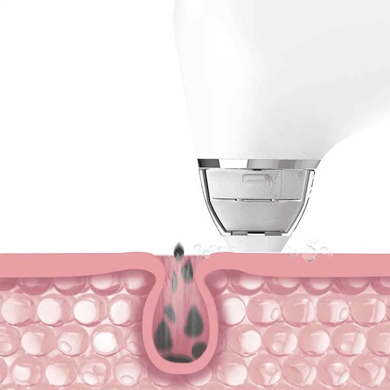 cravo acne eletrica poros maquina limpeza facial beleza pele limpa ferramenta 02