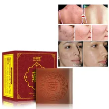 Тибетское мыло ручной работы увлажняющий крем для очищения пор носа против клещей против Очищение акне мыло 100 г