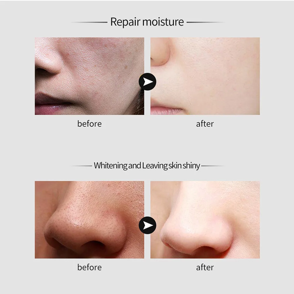 Сужающаяся поры Икра Гиалуроновая кислота Сыворотка для лица контроль над маслом отбеливание сокращение пор крем с эфирным маслом для лица Уход за кожей 12 мл