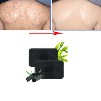 

Hot Deep Anti-freckles Tourmaline Handmade Care Facial Soap Powerful Acne Remover Treatment And Remove Whelk Shrink Pore Soap