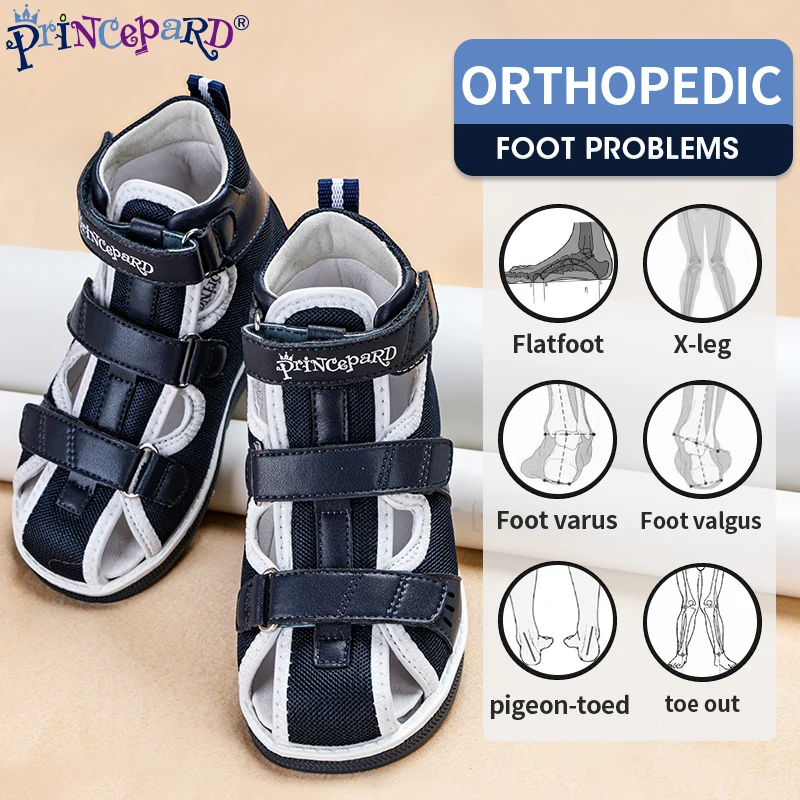 Princepard 2021 Children Orthopedic Shoes for Flat Feet Summer Kids