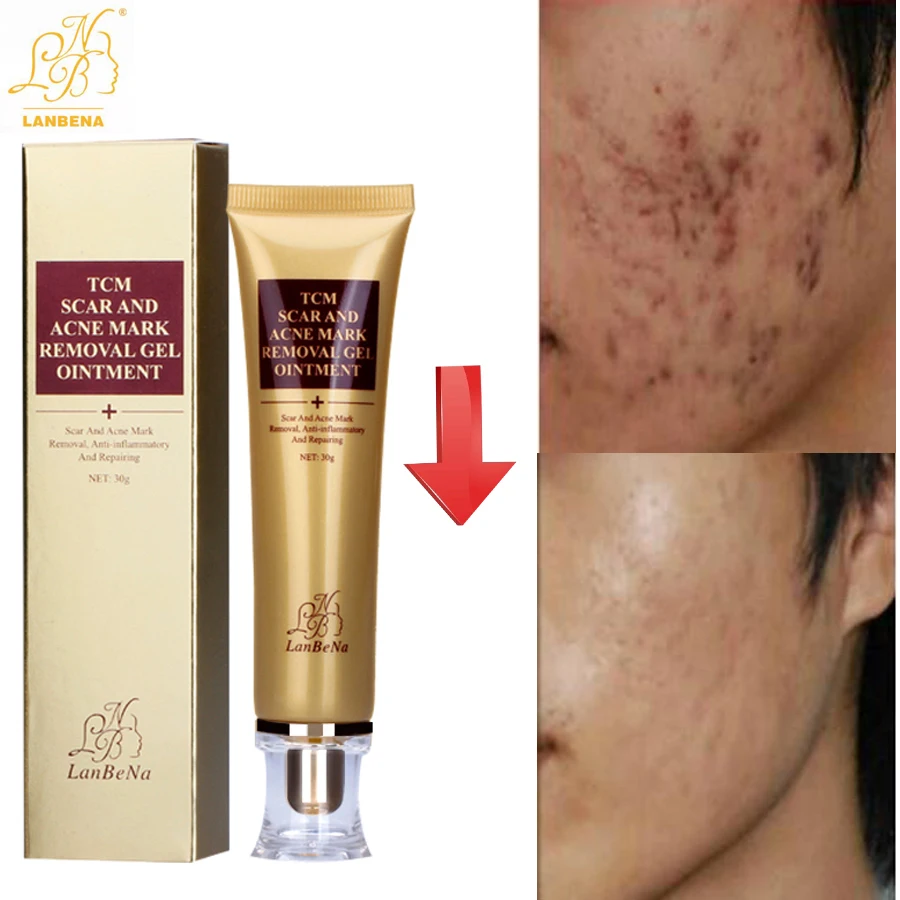 

Lanbena Scar Removal Strentch Marks Acne Treatment Shrink Pores Gel Bleaching Essence Whitening Face Cream Skin Care