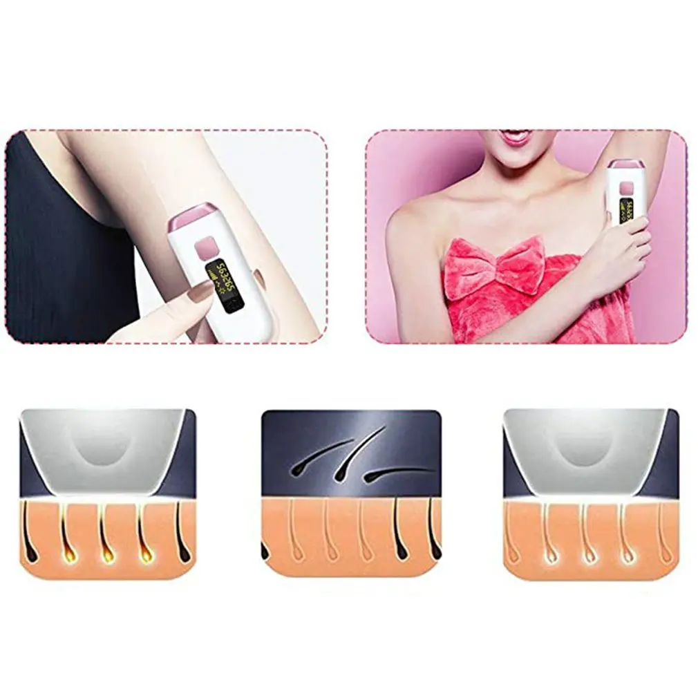 Photon Epilator Image 1