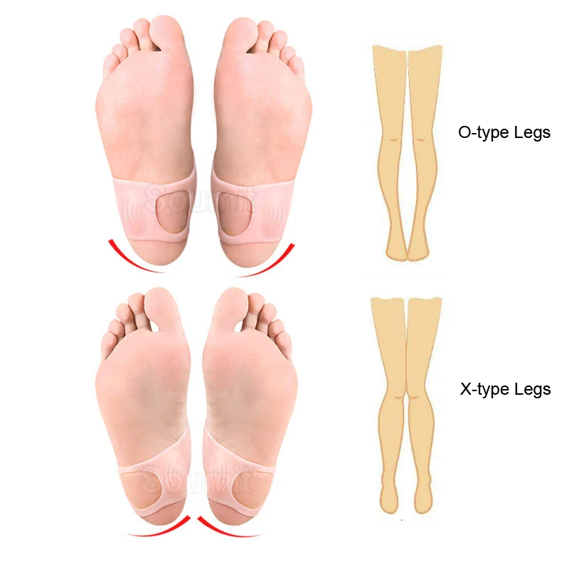 Силиконовый корректор для большого пальца стопы ортопедической стельки подушки