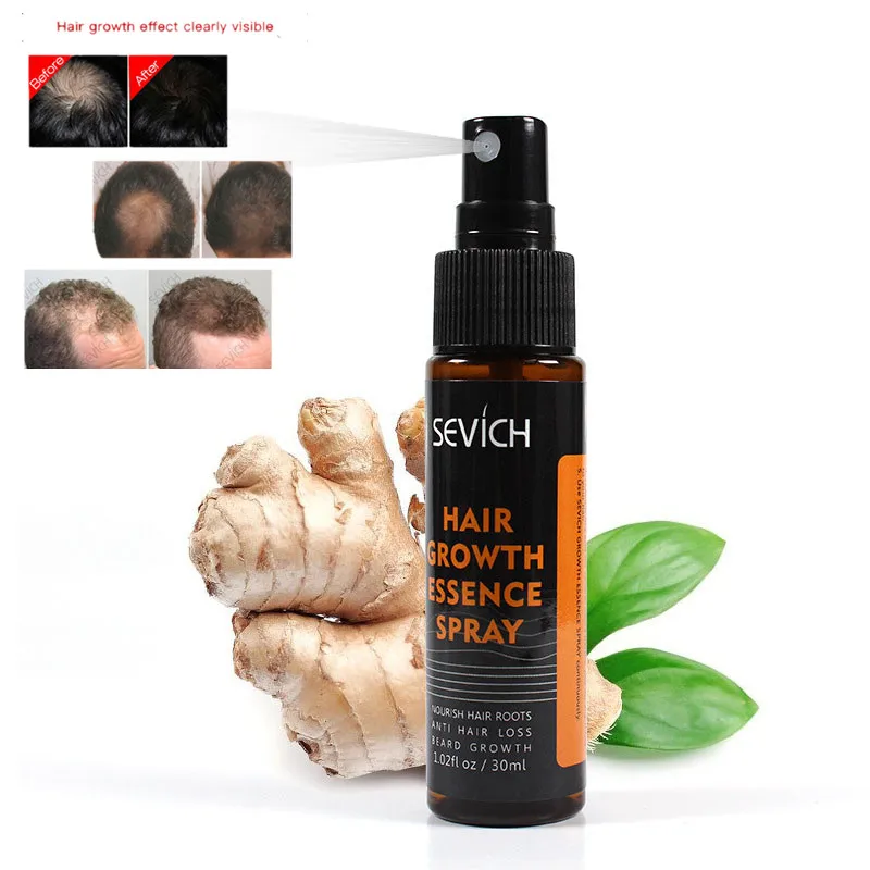 Esencia de crecimiento de pelo rápido para el cuidado del cabello, tratamiento de reparación para pérdida de cabello dañado, 30ml, aceite de maquillaje, cosméticos, Spray para el crecimiento del cabello, TSLM1