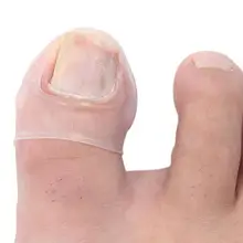 1 пара силиконовых инструментов для коррекции вросших ногтей Невидимый инструмент для лечения вросших ногтей эластичный зажим для выпрямления