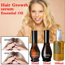 Productos anticaída del cabello