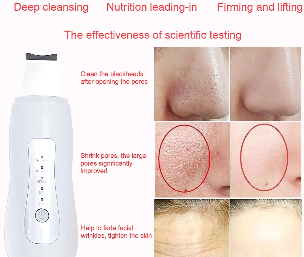 LiCheng ультразвуковая щетка для кожи очиститель для лица пилинг удалить угри очиститель пор перезаряжаемые инструменты для ухода за кожей