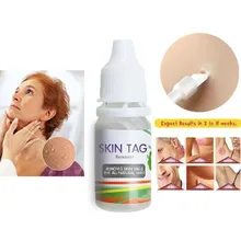 Средство для ухода за кожей бородавок, средство для удаления моль, эффективная бирка для кожи, 10 мл