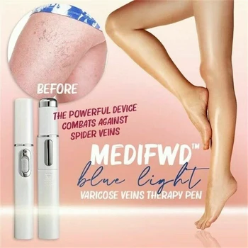

Portable Blue Light Remove Acne Pen Wrinkle Removal Skin Care Tool KG66