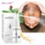 OMY LADY Anti Hair Loss Hair Growth Spray Эфирное Масло Жидкость Для Мужчин Женщин Сухие Волосы Регенерация Ремонт Выпадение Волос Продукты