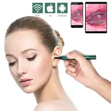 Ear Wax Removal Otoscope Wireless Otoscopes Ear Scope Camera 5MP HD Ear Inspection Endoscope with Earwax Cleaning Tool for Kids