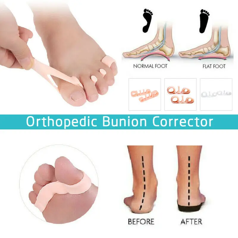 1 Pair Five-hole Toe Pads Silicone Elastic Toe Corrector Straighteners Eversion Overlapping Toe Correction Pads TSLM1