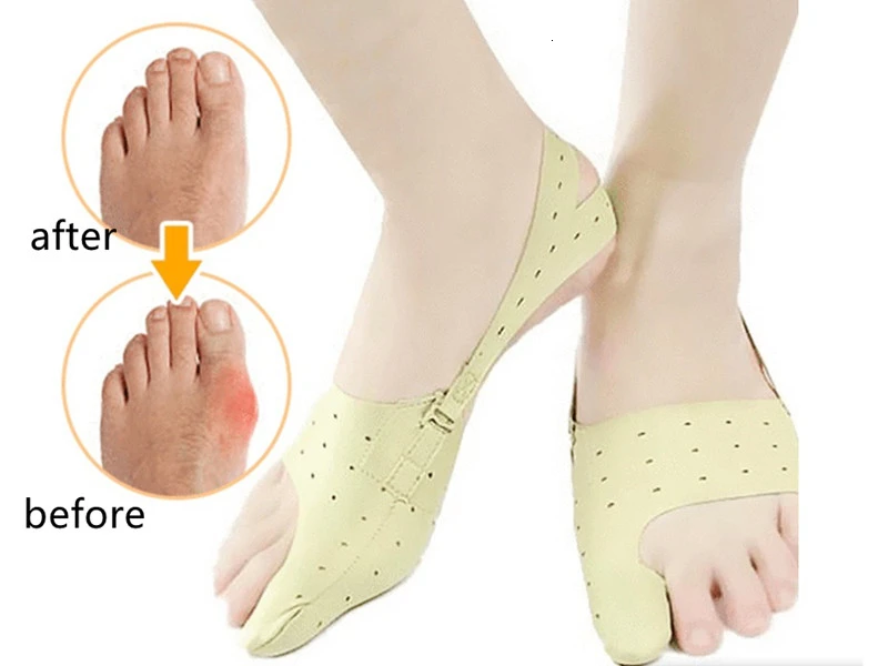 2 шт. Hallux корректор для косточки на ноге разделитель пальцев косточка на большом пальце профилактика бурсита Регулировка боли выпрямление согнутых ног Уход за ногами