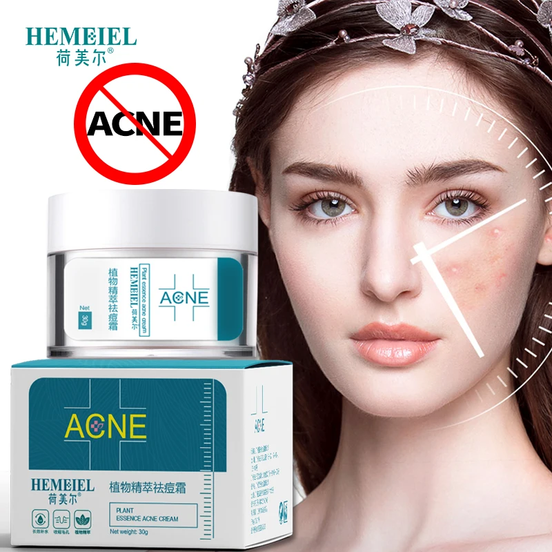 acne moisturizing cream