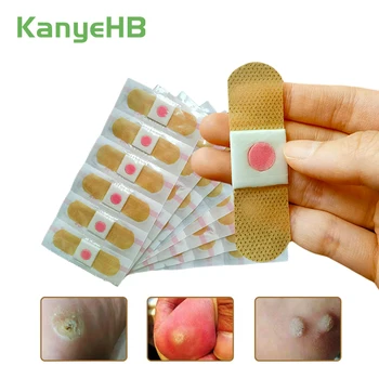 

30pcs New Foot Corn Removal Plaster Warts Thorn Remove Corn Foot Patches Anti-germ Pad Patch Plantar Killer Feet Foot Treatment