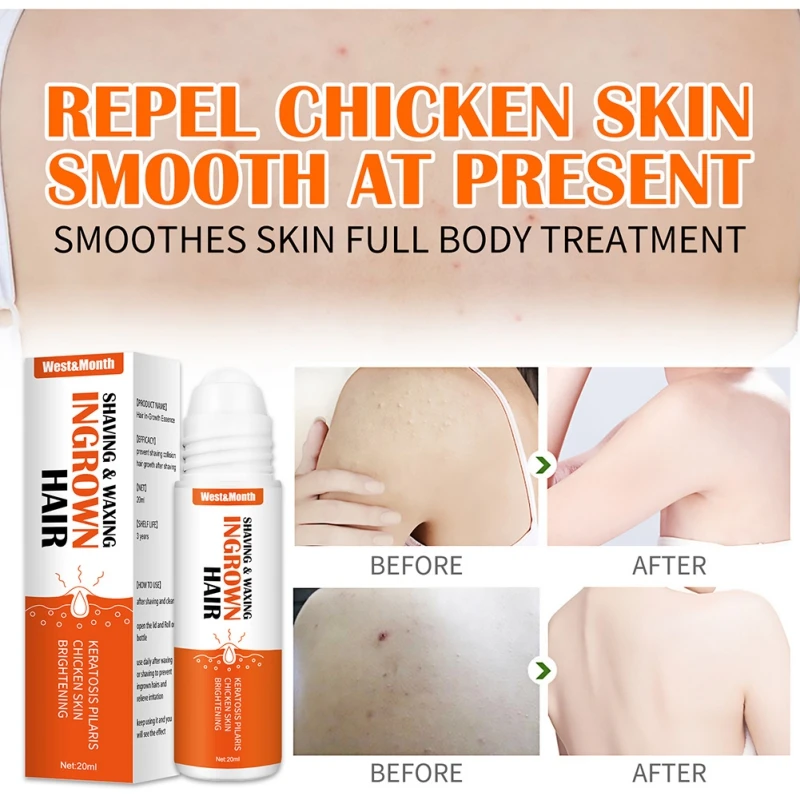 After Shave Repair Serum 20ml Soothes And Moisturizes for Ingrown Hair Skin Care