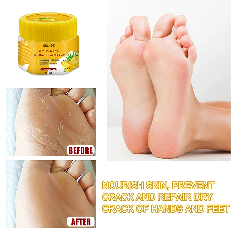 Supreme Moisturizing Banana Heel balm, Foot, Elbow, Knee Cracked cream  (Made in Thailand ) Price in India - Buy Supreme Moisturizing Banana Heel  balm, Foot, Elbow, Knee Cracked cream (Made in Thailand )