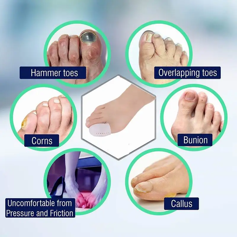 1 Pairs Foot Finger Corrector Big Toe Separator Pedicure Foot Hallux Valgus Ortopedia Guard Cushion Toe Protector Foot Care 1 Pairs Foot Finger Corrector Big Toe Separator Pedicure Foot Hallux Valgus Ortopedia Guard Cushion Toe Protector Foot Care