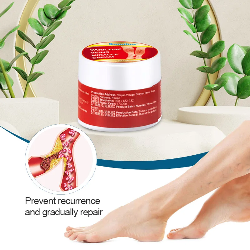 1 قطعة الدوالي كريم علاج التهاب الأوعية الدموية ال...