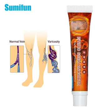 

1pcs Sumifun Varicose Veins Cream Varicosity Angiitis Remedy Ointment Veins Pain Phlebitis Herb Skin Care Medical Plaster P1109
